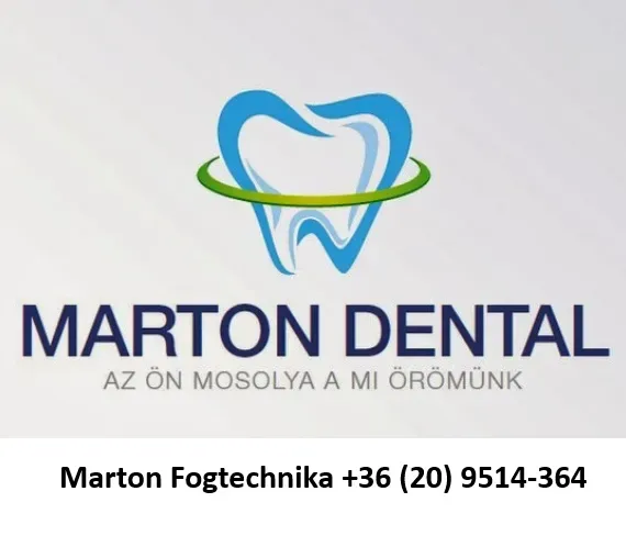 Marton Fogtechnika
